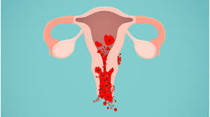 Uterine Bleeding Care | AasthaLok Hospital