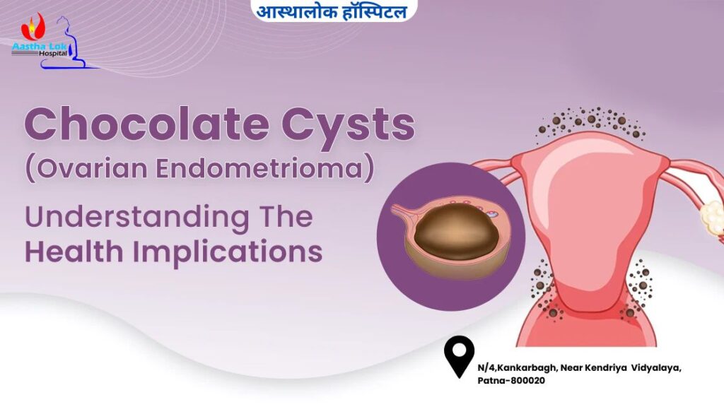 Chocolate Cysts