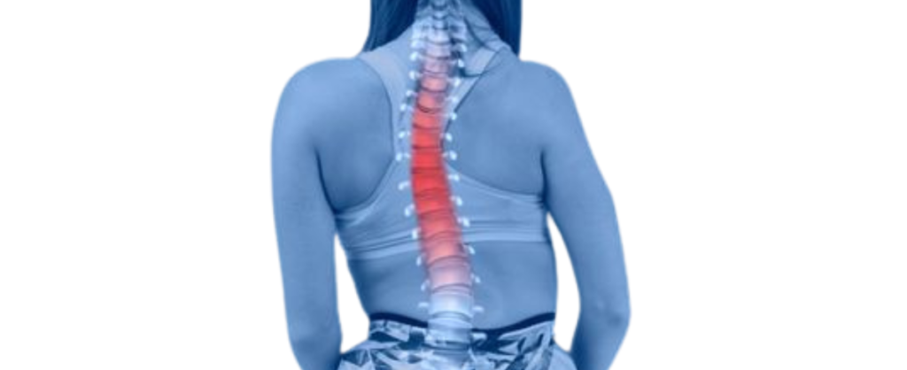 All Curves Are Not Fine – Expert Spine Care