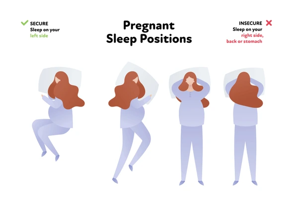Best Sleeping Position During Pregnancy | AasthaLok Hospital