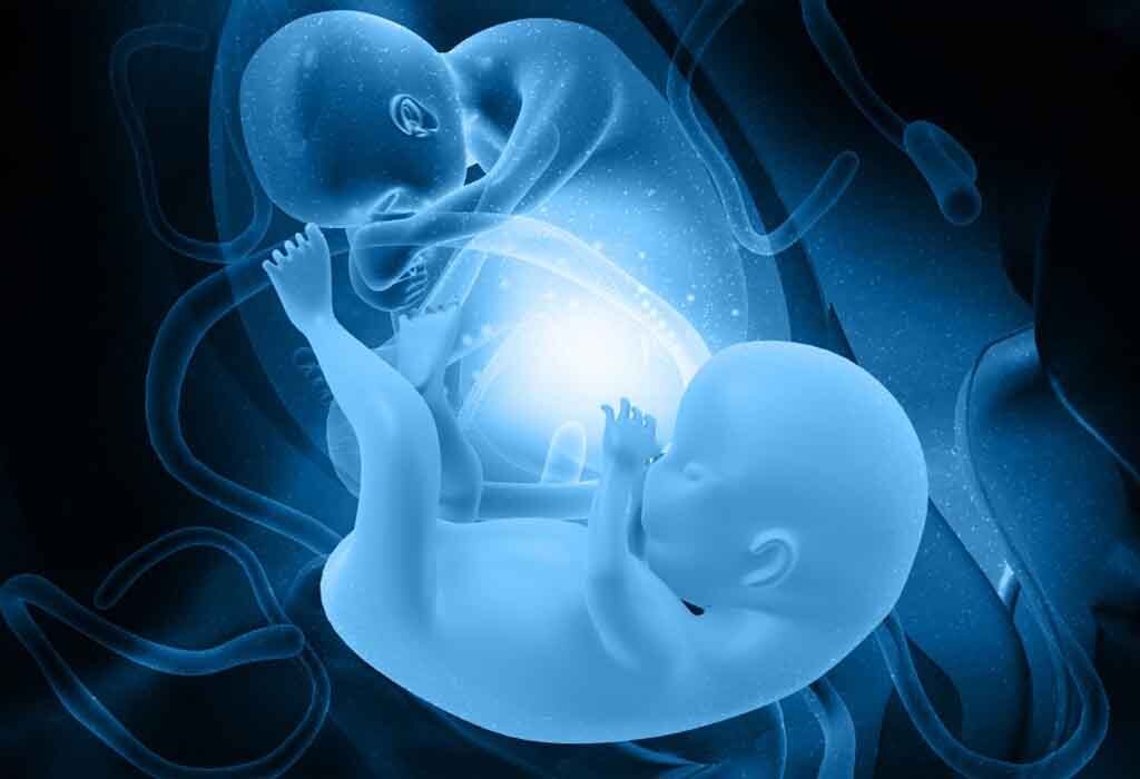 Twin Baby | AasthaLok Hospital